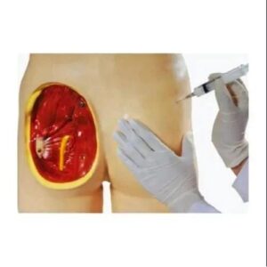 Adult Intramuscular Injection Training Model