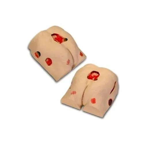 PVC Decubitus Ulcer Treatment Model 1 PVC Decubitus Ulcer Treatment Model